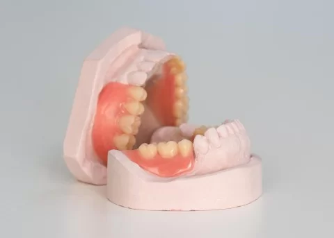 Gedeeltelijke prothese